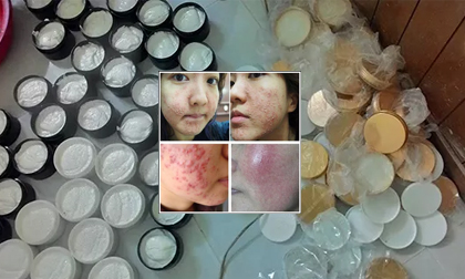 Mỹ phẩm tẩy trắng da cấp tốc giá rẻ, tác hại khôn lường