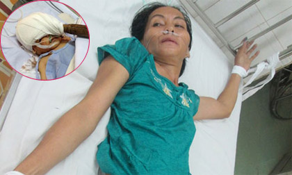 Chân dung nghi phạm đâm dao xuyên não bé sơ sinh