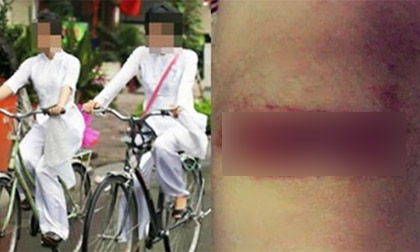Rạch đùi 18 thiếu nữ, trò biến thái của gã công tử si tình