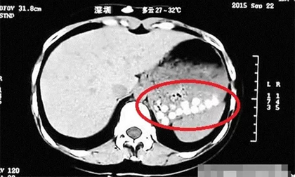 Rúng động: Trà sữa trân châu Trung Quốc làm từ lốp xe cũ, đế giày