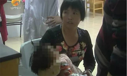 Bà ngoại bất cẩn, bé 1 tuổi nguy kịch vì bị đũa đâm xuyên miệng