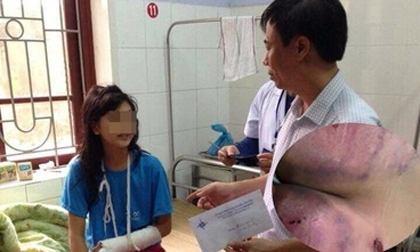 Vụ cha ruột đánh con gãy tay, dập mông: Ghen tuông biến người cha thành 'hổ dữ'?