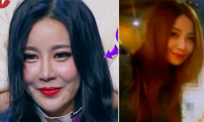 Phẫu thuật thẩm mỹ 20 lần trong 2 năm, hot girl bị mẹ dọa từ mặt trên sóng truyền hình