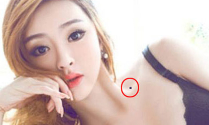 Nốt ruồi trên bầu ngực của phụ nữ tiết lộ điều gì?