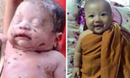 Bé sơ sinh sống sót kỳ diệu ở Thái Lan ngày càng bụ bẫm