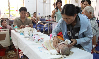Hai bé bỏng xăng trong vụ cả nhà bị đốt đang nguy kịch
