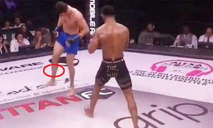 MMA: Đá đối thủ, gãy chân kinh hoàng