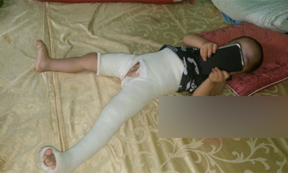 Tuyên Quang: Cô giáo mầm non đạp gãy xương đùi cháu nhỏ 3 tuổi?