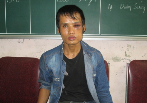 Bắt trùm ma tuý, thu ‘kho’ vũ khí: 2 công an dính máu nghi nhiễm HIV - Ảnh 1