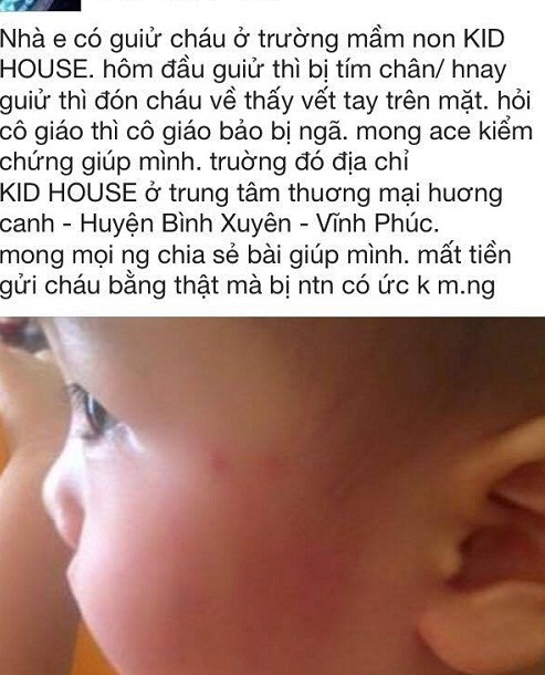 '. Cơ sở mầm non để trẻ 18 tháng bị ngã, chưa được cấp phép hoạt động .'