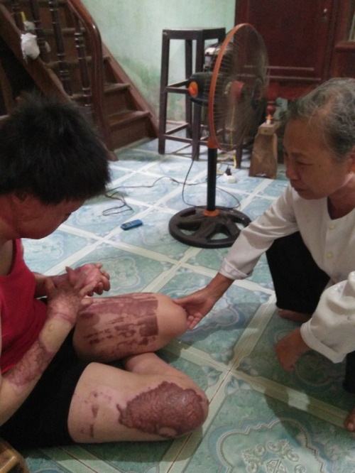 ngvo1-xahoi.com.vn-1468460901