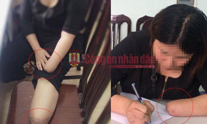 Hãi hùng lời thú nhận thuê chặt chân tay để trục lợi của cô gái trẻ