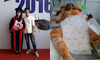 Cô gái xinh đẹp phải gác lại ước mơ vì tai nạn từ trên trời rơi xuống
