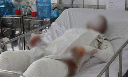 Cô gái nghi bị người tình đốt, phải nhảy lầu thoát thân đang nguy kịch