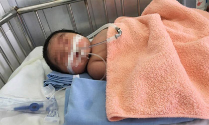 Bác sĩ trưởng khoa sản chậm ký giấy mổ, con sản phụ ra đời tím tái, suy hô hấp rồi tử vong?