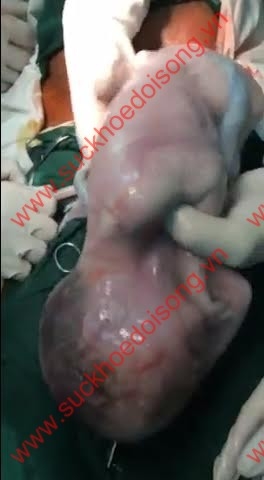 sinhba1-xahoi.com.vn-1473756089