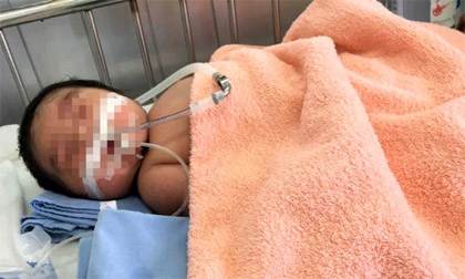 Bộ Y tế yêu cầu làm rõ nguyên nhân trẻ sơ sinh tử vong