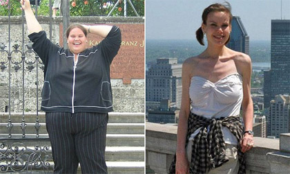 Câu chuyện kinh ngạc của cô gái giảm từ 187kg xuống còn 49kg và hậu quả đáng tiếc