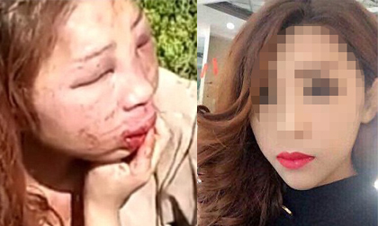Hotgirl xinh như mộng bị đánh tàn tạ ném bên đường gây sốc?