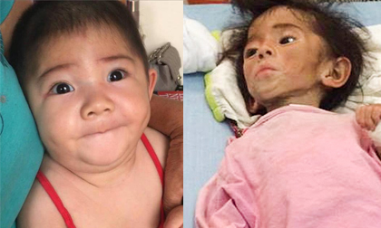 Hình ảnh mới của bé gái Lào Cai 14 tháng tuổi nặng 3,5kg sau hơn 3 tháng được mẹ nuôi chăm sóc