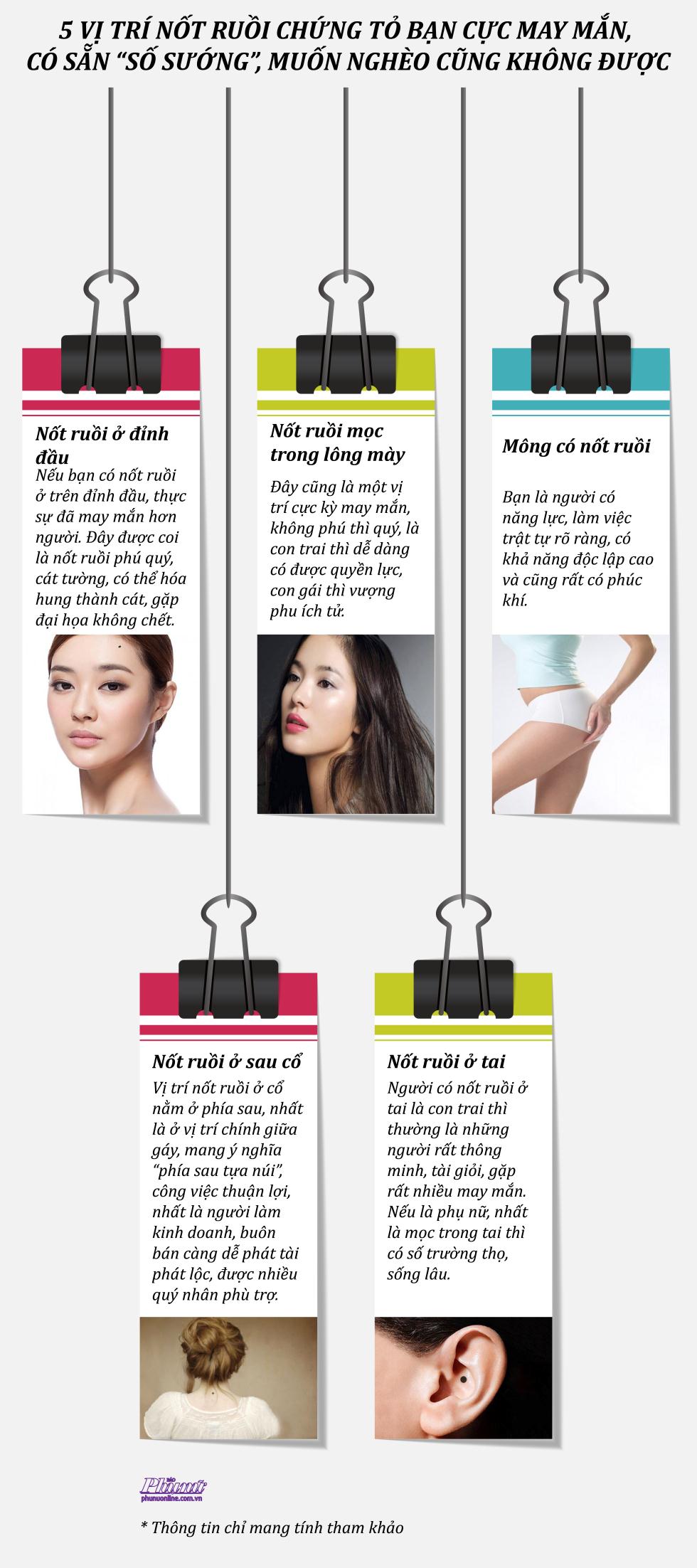 5 vi tri not ruoi chung to ban cuc may man, co san 'so suong', muon ngheo cung khong duoc