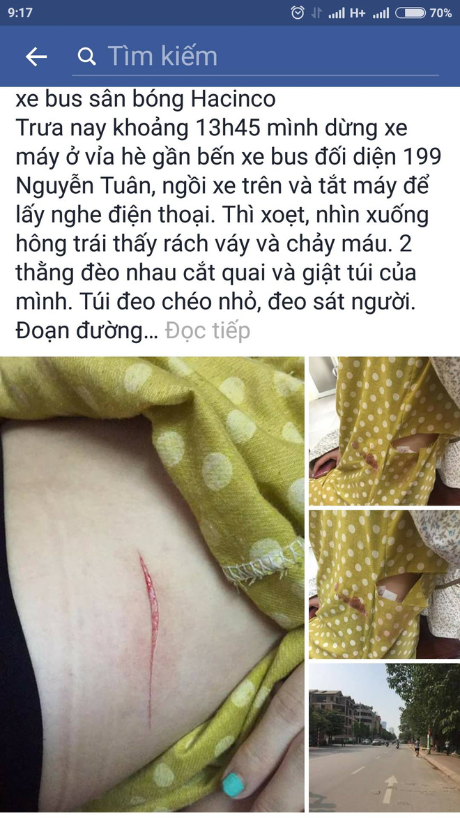Hà Nội: Cô gái trẻ bị rạch đùi, cướp túi xách ngay giữa ban ngày? - Ảnh 1.
