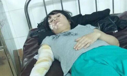 Vụ dúi đầu vợ vào lửa vì làm đẹp: Cuộc sống địa ngục trần gian của người vợ gần 10 năm ròng