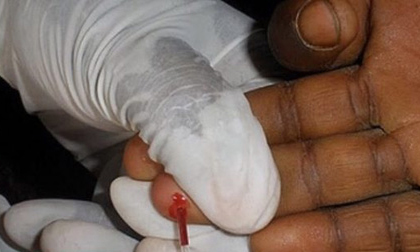 Các bác sĩ xác nhận: HIV/AIDS đã có thể được chữa trị hoàn toàn