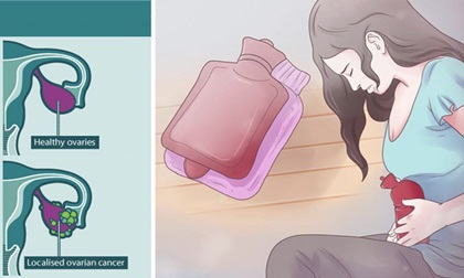 Đừng coi thường những cơn đau bụng vì nó có thể là dấu hiệu cảnh báo ung thư