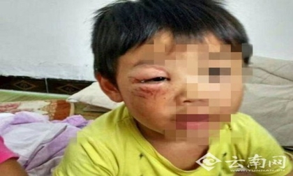 Rơi nước mắt những vụ bố đẻ ngược đãi con thậm tệ để.... dằn mặt vợ