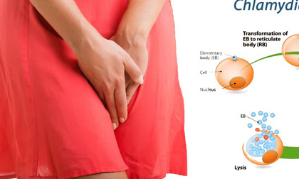 Đây là những bệnh tình dục bạn có thể đã mắc mà không hề hay biết
