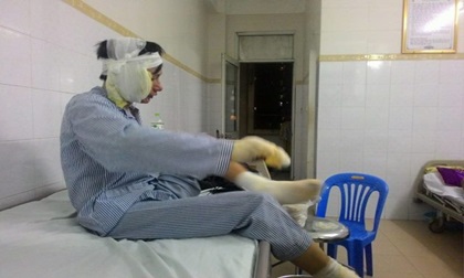 Nạn nhân vụ nổ bốt điện kinh hoàng ở Hà Nội: “Đây là ngày vào sinh ra tử của tôi”
