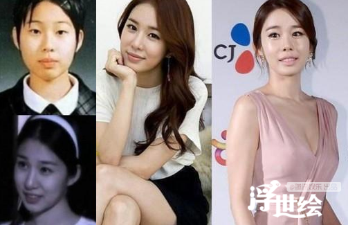Giai nhân châu Á tự hủy hoại nhan sắc vì tiêm botox quá đà 1