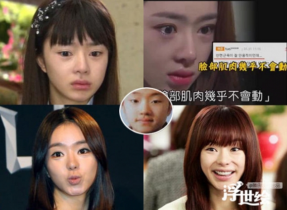 Giai nhân châu Á tự hủy hoại nhan sắc vì tiêm botox quá đà 12