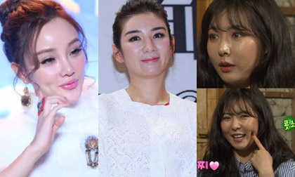 Giai nhân châu Á tự hủy hoại nhan sắc vì tiêm botox quá đà