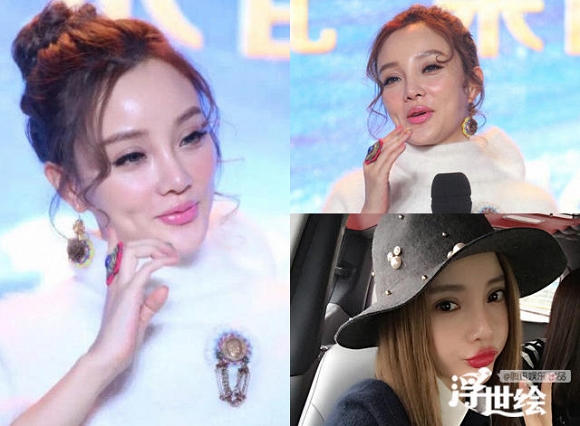 Giai nhân châu Á tự hủy hoại nhan sắc vì tiêm botox quá đà 2