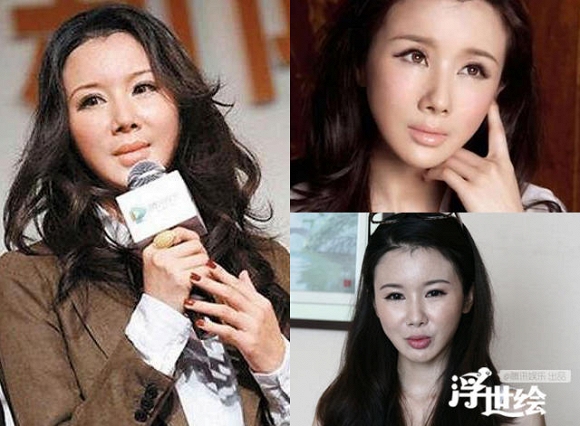 Giai nhân châu Á tự hủy hoại nhan sắc vì tiêm botox quá đà 7