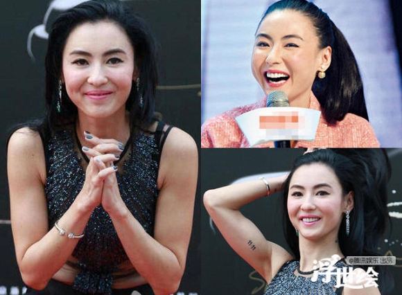 Giai nhân châu Á tự hủy hoại nhan sắc vì tiêm botox quá đà 8
