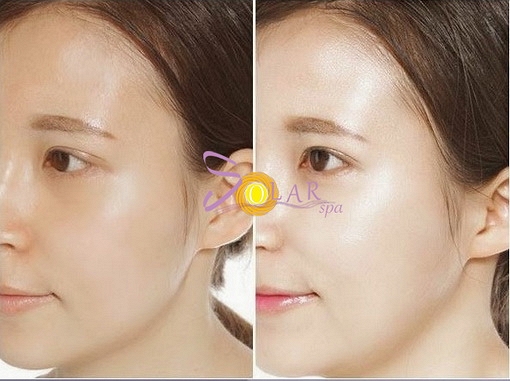 Trắng hồng - căng bóng da hiệu quả chỉ sau 1 lần duy nhất