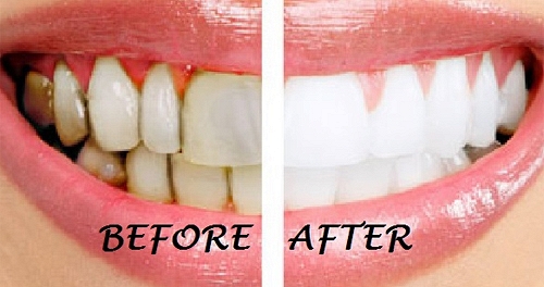 10 bí quyết giúp bạn trở nên xinh đẹp mà không cần make up 0 10 bí quyết giúp bạn trở nên xinh đẹp mà không cần make up 0