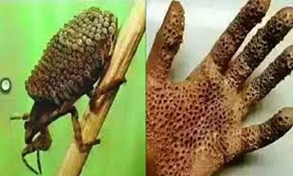 Loài côn trùng gây bỏng da, gây tử vong trong vài ngày