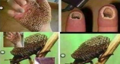 côn trùng gây bỏng da chết người 0