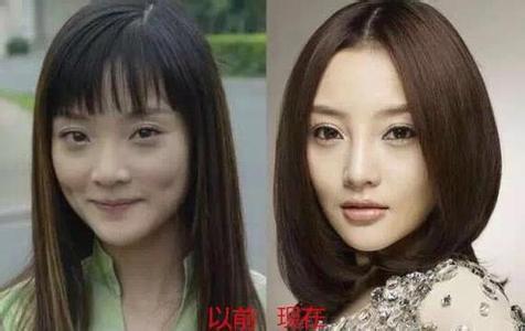 Những sao châu Á bị vạch bằng chứng thẩm mỹ vùng mũi 17