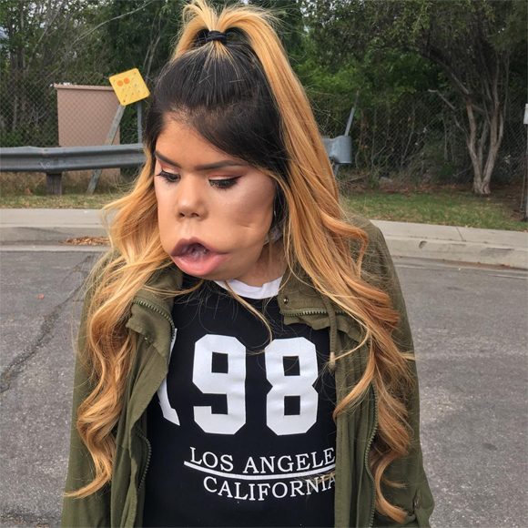  Vlogger làm đẹp xấu xí nhưng rất tự tin 9
