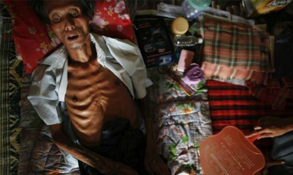 Năm 2030, “kết liễu” đại dịch AIDS?