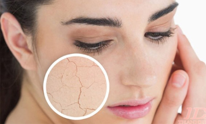 Cách tăng cường độ ẩm cho da vào mùa đông