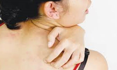 Bà bầu bị giời leo có ảnh hưởng đến thai nhi không?