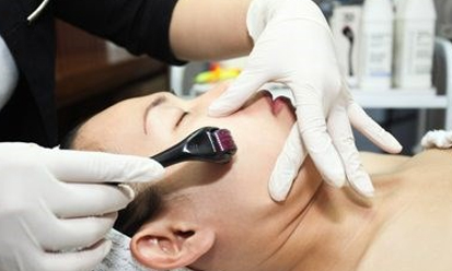 Lăn kim làm đẹp – lăn rủi ro