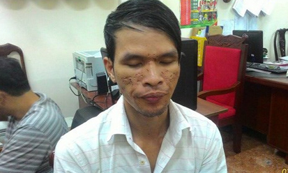 Đường sa ngã của nghi can hành hạ bé trai Campuchia