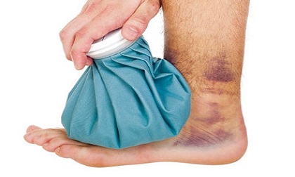 Cách chữa bong gân tay chân hiệu quả, mau khỏi